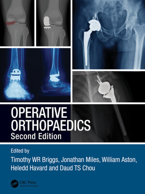 cover image of Operative Orthopaedics